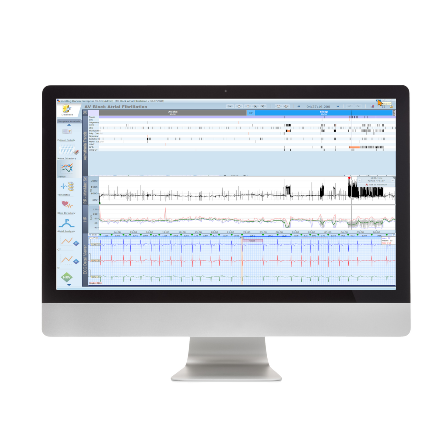 Schiller ECG Holter Software for Darwin 2