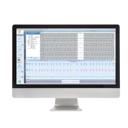 Schiller ECG Holter Software for Darwin 2