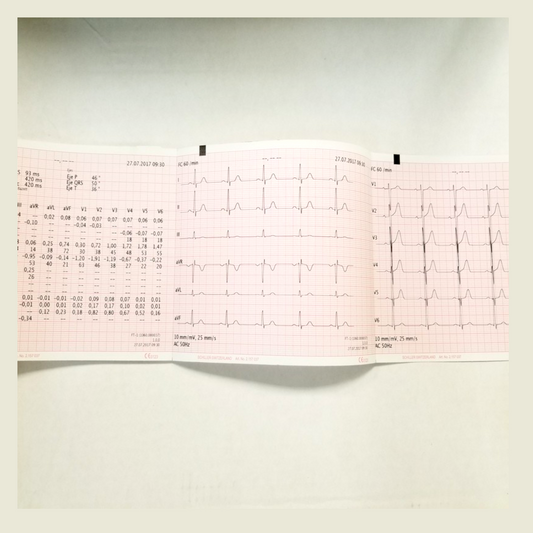 Paper for SCHILLER ECG FT-1