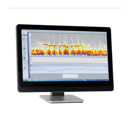 Schiller ECG Holter Software for Darwin 2