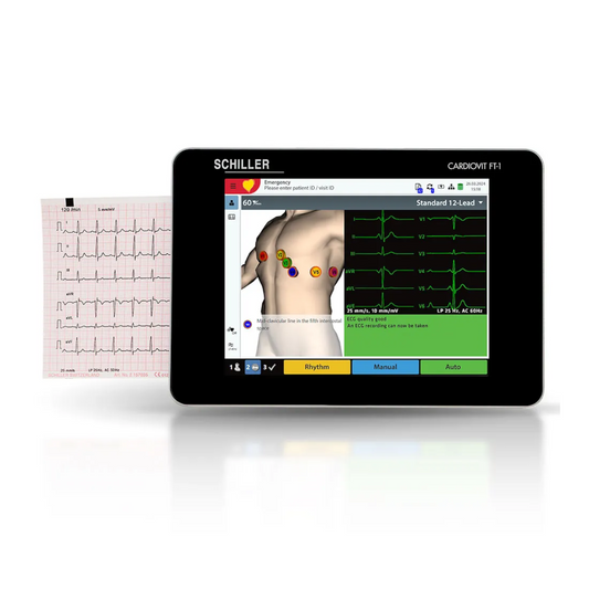 SCHILLER CARDIOVIT FT-1 Interpretative 12 Channel Ecg